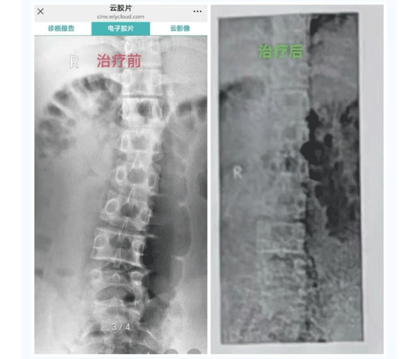 內容圖片11.gif